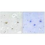 Immunohistochemistry - Anti-STK39 (phospho Ser325) Antibody (A8187) - Antibodies.com