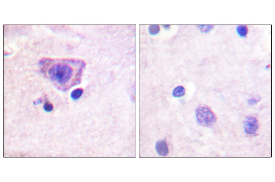 Immunohistochemistry - Anti-RyR2 (phospho Ser2808) Antibody (A0570) - Antibodies.com