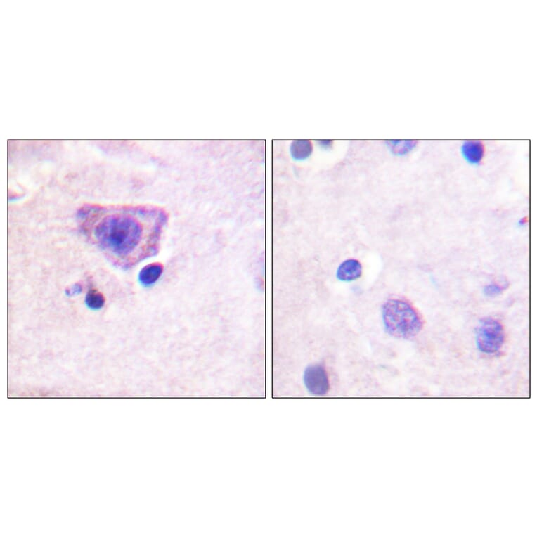 Immunohistochemistry - Anti-RyR2 (phospho Ser2808) Antibody (A0570) - Antibodies.com