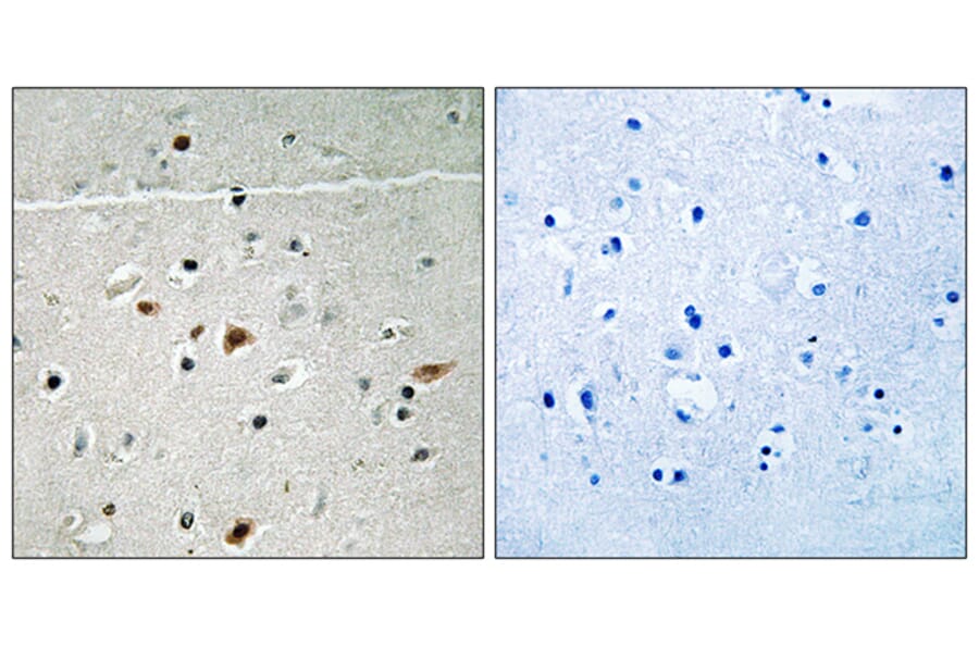 Immunohistochemistry - Anti-LIMK2 (phospho Ser283) Antibody (A8045) - Antibodies.com