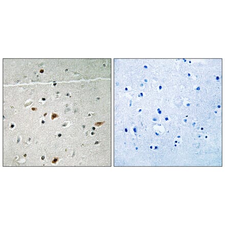 Immunohistochemistry - Anti-LIMK2 (phospho Ser283) Antibody (A8045) - Antibodies.com