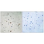 Immunohistochemistry - Anti-LIMK2 (phospho Ser283) Antibody (A8045) - Antibodies.com