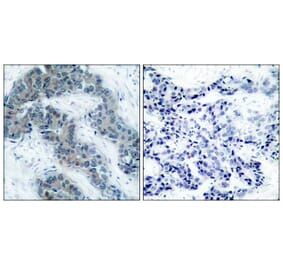 Immunohistochemistry - Anti-JAK2 (phospho Tyr1007) Antibody (A7126) - Antibodies.com