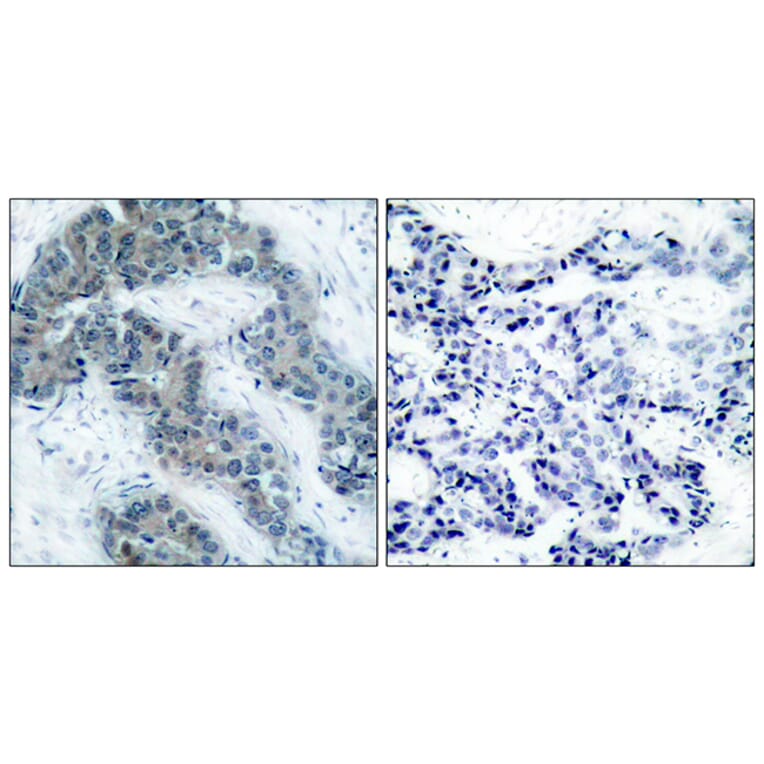 Immunohistochemistry - Anti-JAK2 (phospho Tyr1007) Antibody (A7126) - Antibodies.com