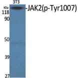 Western Blot - Anti-JAK2 (phospho Tyr1007) Antibody (A7126) - Antibodies.com