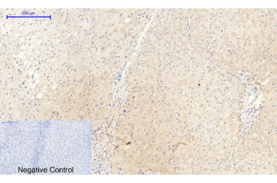 Immunohistochemistry - Anti-JAK2 (phospho Tyr1007) Antibody (A7126) - Antibodies.com