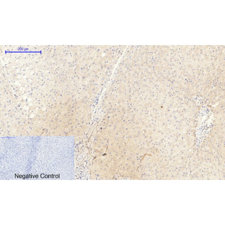 Immunohistochemistry - Anti-JAK2 (phospho Tyr1007) Antibody (A7126) - Antibodies.com