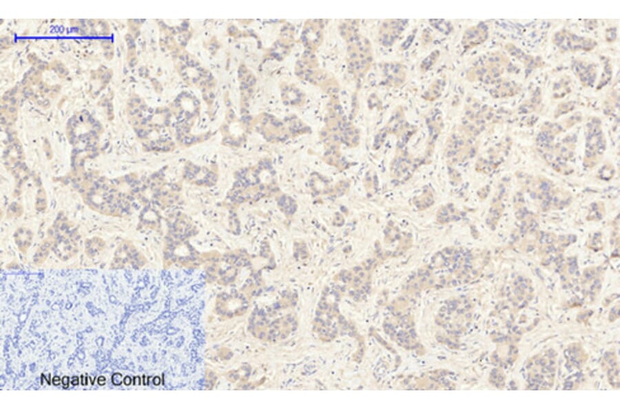 Immunohistochemistry - Anti-JAK2 (phospho Tyr1007) Antibody (A7126) - Antibodies.com