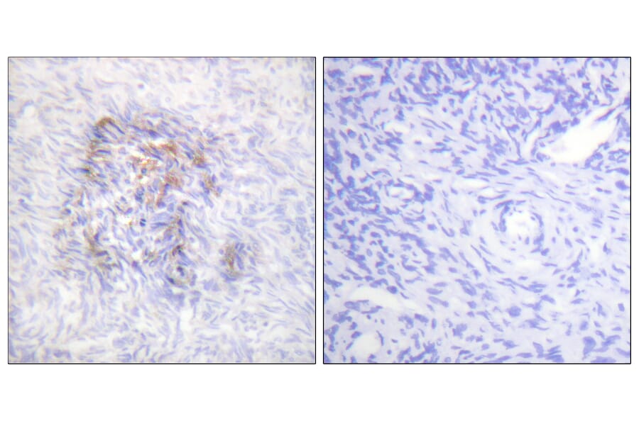 Immunohistochemistry - Anti-IREB1 (phospho Ser138) Antibody (A1076) - Antibodies.com