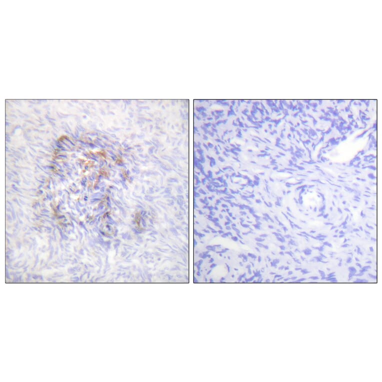 Immunohistochemistry - Anti-IREB1 (phospho Ser138) Antibody (A1076) - Antibodies.com