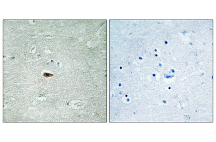 Immunohistochemistry - Anti-HER3 (phospho Tyr1328) Antibody (A0946) - Antibodies.com