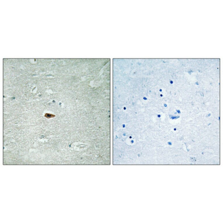 Immunohistochemistry - Anti-HER3 (phospho Tyr1328) Antibody (A0946) - Antibodies.com