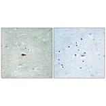 Immunohistochemistry - Anti-HER3 (phospho Tyr1328) Antibody (A0946) - Antibodies.com