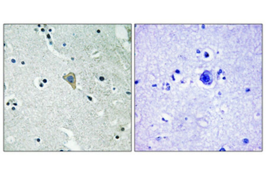 Immunohistochemistry - Anti-HER3 (phospho Tyr1328) Antibody (A0946) - Antibodies.com