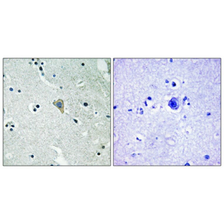 Immunohistochemistry - Anti-HER3 (phospho Tyr1328) Antibody (A0946) - Antibodies.com