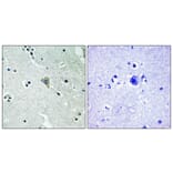 Immunohistochemistry - Anti-HER3 (phospho Tyr1328) Antibody (A0946) - Antibodies.com