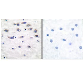 Immunohistochemistry - Anti-GluR1 (phospho Ser849) Antibody (A7094) - Antibodies.com