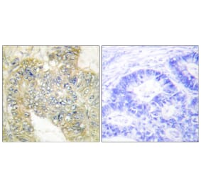 Immunohistochemistry - Anti-Desmin (phospho Ser60) Antibody (A1196) - Antibodies.com