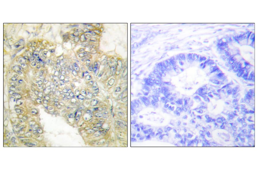 Immunohistochemistry - Anti-Desmin (phospho Ser60) Antibody (A1196) - Antibodies.com