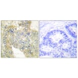 Immunohistochemistry - Anti-Desmin (phospho Ser60) Antibody (A1196) - Antibodies.com