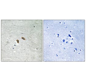 Immunohistochemistry - Anti-C-RAF (phospho Thr269) Antibody (A8177) - Antibodies.com