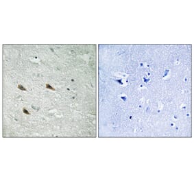 Immunohistochemistry - Anti-C-RAF (phospho Ser289) Antibody (A8178) - Antibodies.com
