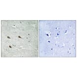 Immunohistochemistry - Anti-C-RAF (phospho Ser289) Antibody (A8178) - Antibodies.com