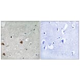 Immunohistochemistry - Anti-COPS1 (phospho Ser454) Antibody (A8322) - Antibodies.com