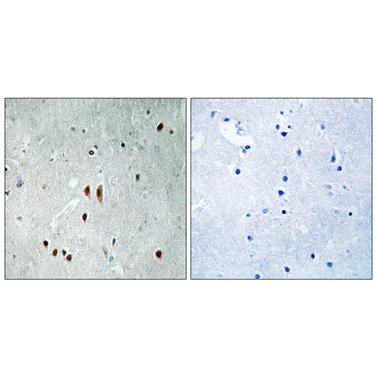 Immunohistochemistry - Anti-CNOT2 (phospho Ser101) Antibody (A8387) - Antibodies.com