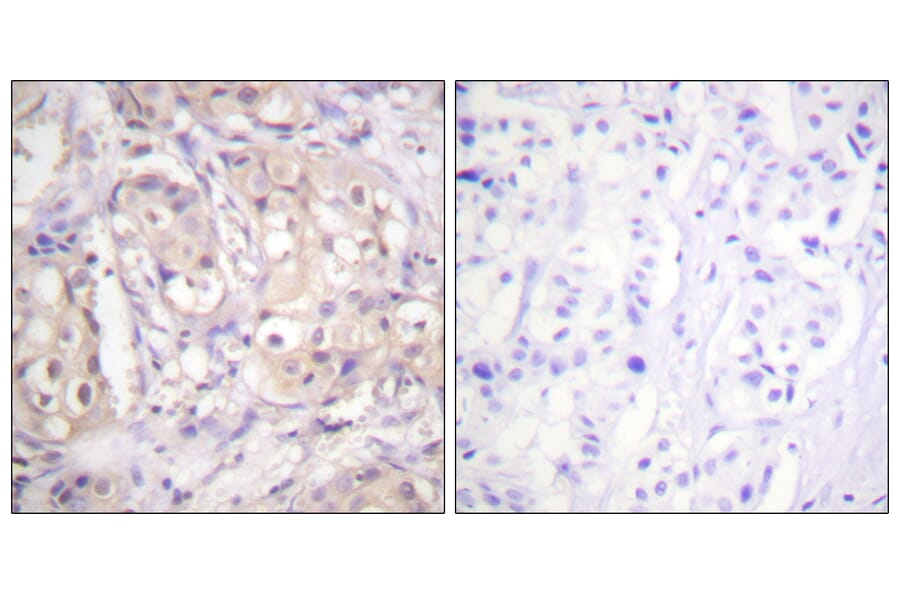 Immunohistochemistry - Anti-B-RAF (phospho Thr599) Antibody (A0780) - Antibodies.com