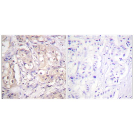 Immunohistochemistry - Anti-B-RAF (phospho Thr599) Antibody (A0780) - Antibodies.com