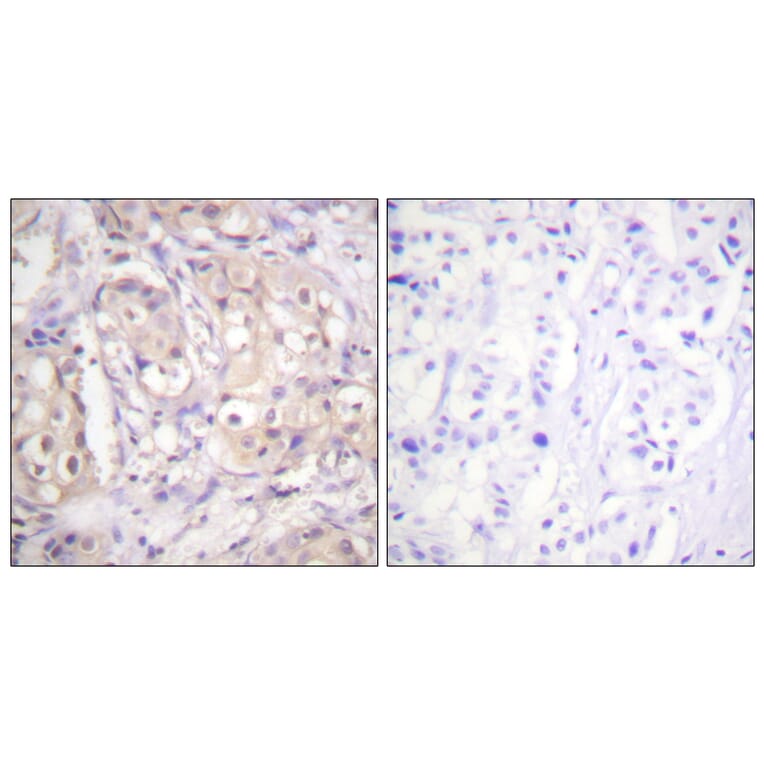 Immunohistochemistry - Anti-B-RAF (phospho Thr599) Antibody (A0780) - Antibodies.com