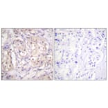 Immunohistochemistry - Anti-B-RAF (phospho Thr599) Antibody (A0780) - Antibodies.com