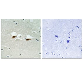 Immunohistochemistry - Anti-ATF-2 (phospho Ser472) Antibody (A8294) - Antibodies.com