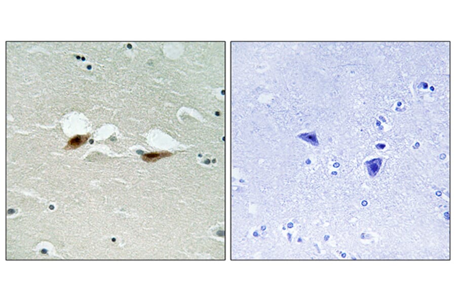 Immunohistochemistry - Anti-ATF-2 (phospho Ser472) Antibody (A8294) - Antibodies.com