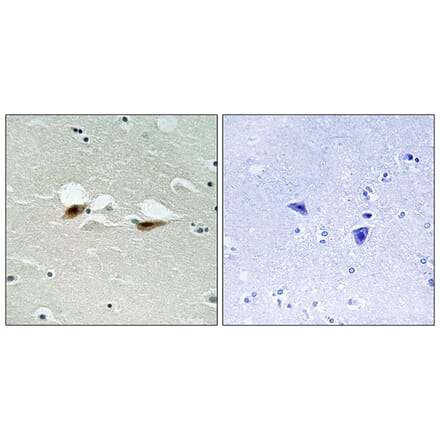 Immunohistochemistry - Anti-ATF-2 (phospho Ser472) Antibody (A8294) - Antibodies.com