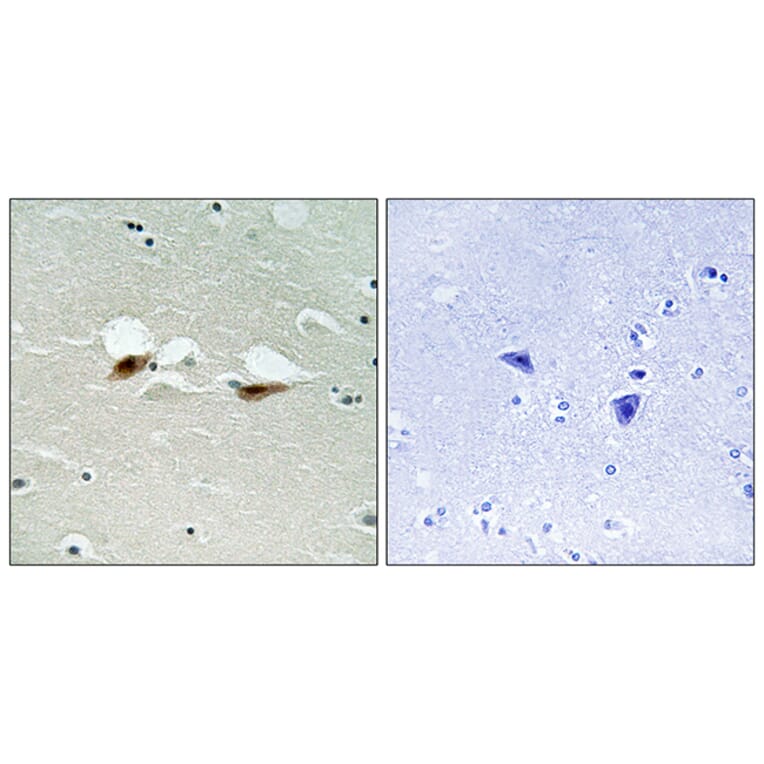 Immunohistochemistry - Anti-ATF-2 (phospho Ser472) Antibody (A8294) - Antibodies.com