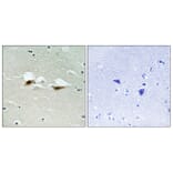 Immunohistochemistry - Anti-ATF-2 (phospho Ser472) Antibody (A8294) - Antibodies.com