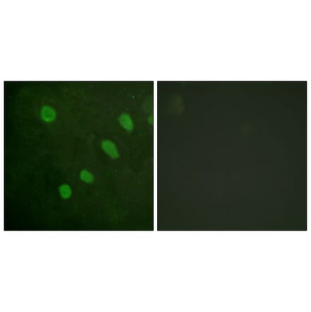 Immunofluorescence - Anti-ATF2 (phospho Ser480) Antibody (A0819) - Antibodies.com