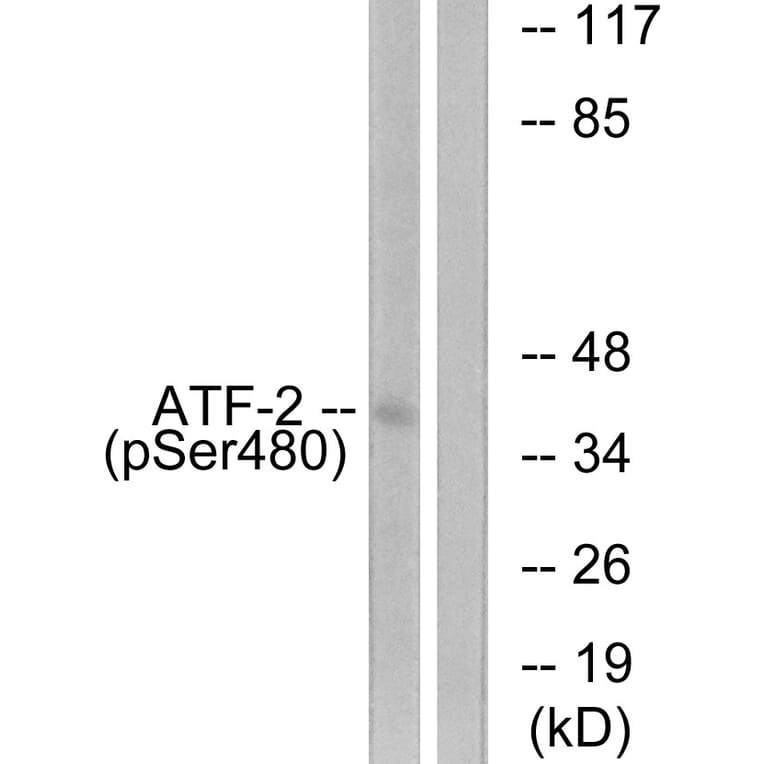 Western Blot - Anti-ATF2 (phospho Ser480) Antibody (A0819) - Antibodies.com