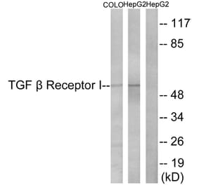 Western Blot - Anti-TGF beta Receptor I Antibody (B1126) - Antibodies.com