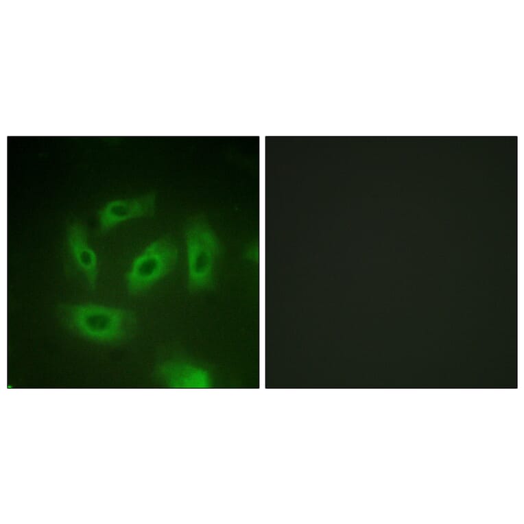 Immunofluorescence - Anti-TGF beta Receptor I Antibody (B1126) - Antibodies.com