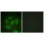 Immunofluorescence - Anti-TGF beta Receptor I Antibody (B1126) - Antibodies.com