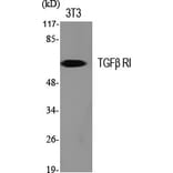 Western Blot - Anti-TGF beta Receptor I Antibody (B1126) - Antibodies.com