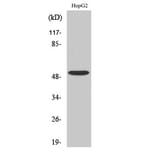 Western Blot - Anti-TGF beta Receptor I Antibody (B1126) - Antibodies.com