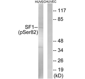 Western Blot - Anti-SF1 (phospho Ser82) Antibody (A0572) - Antibodies.com