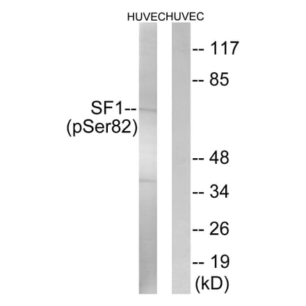 Western Blot - Anti-SF1 (phospho Ser82) Antibody (A0572) - Antibodies.com