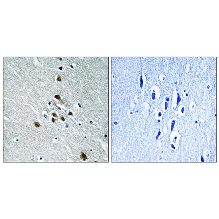 Immunohistochemistry - Anti-SF1 (phospho Ser82) Antibody (A0572) - Antibodies.com