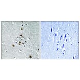 Immunohistochemistry - Anti-SF1 (phospho Ser82) Antibody (A0572) - Antibodies.com