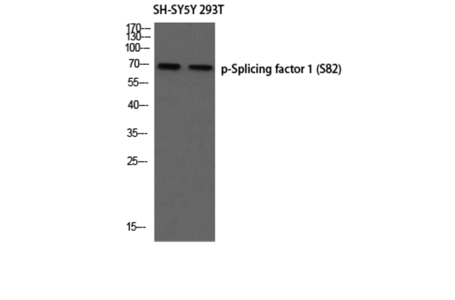 Western Blot - Anti-SF1 (phospho Ser82) Antibody (A0572) - Antibodies.com